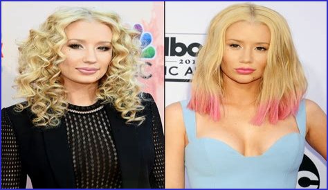 Iggy Azalea recently had a nose job & chin implant, says an Iggy source