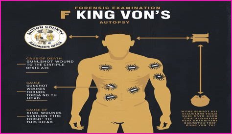 King Von Autopsy: New Details Emerge, Fueling Fan Theories