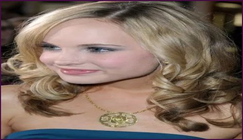 Meaghan Jette Martin Plastic Surgery Before and After